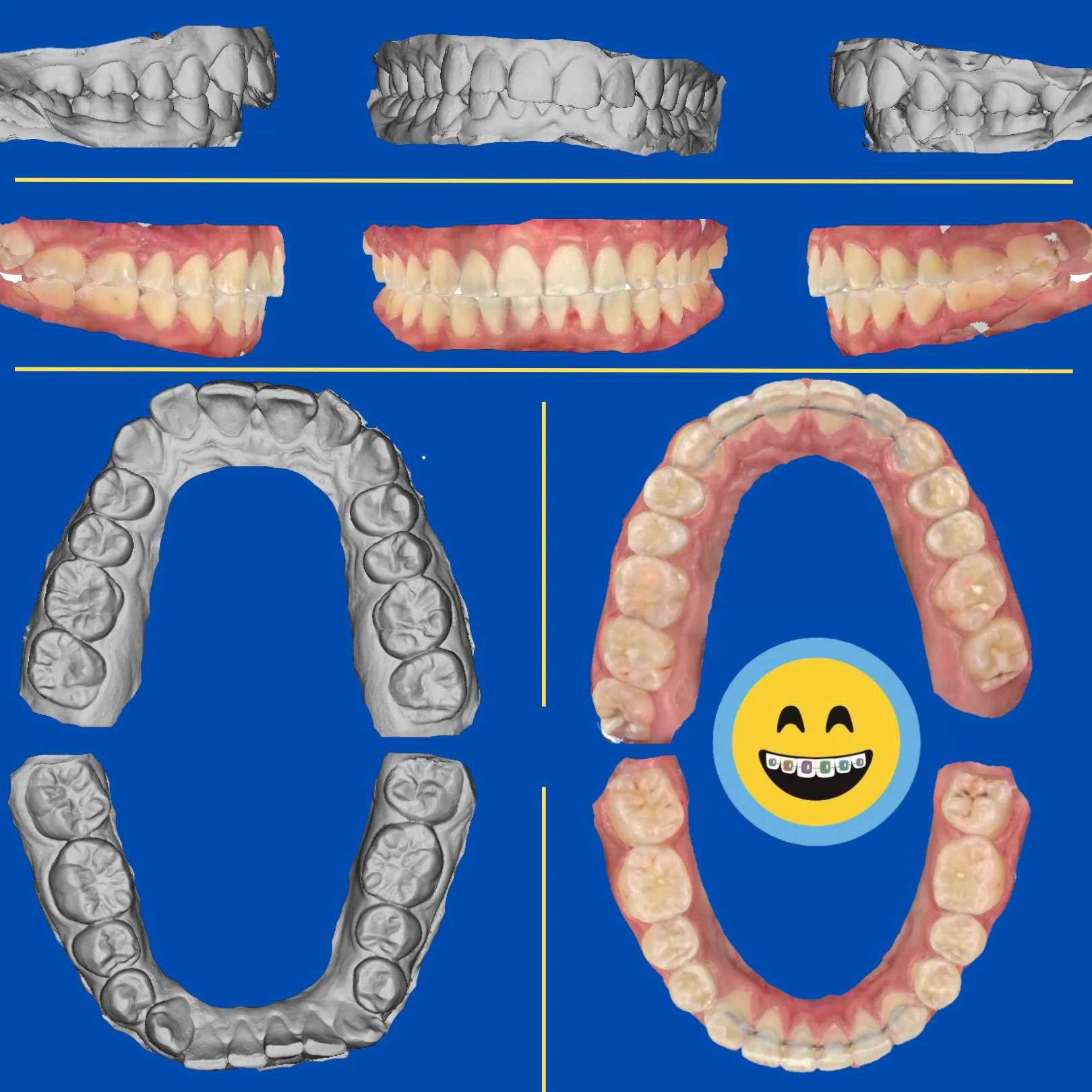 Fernando - Before and After