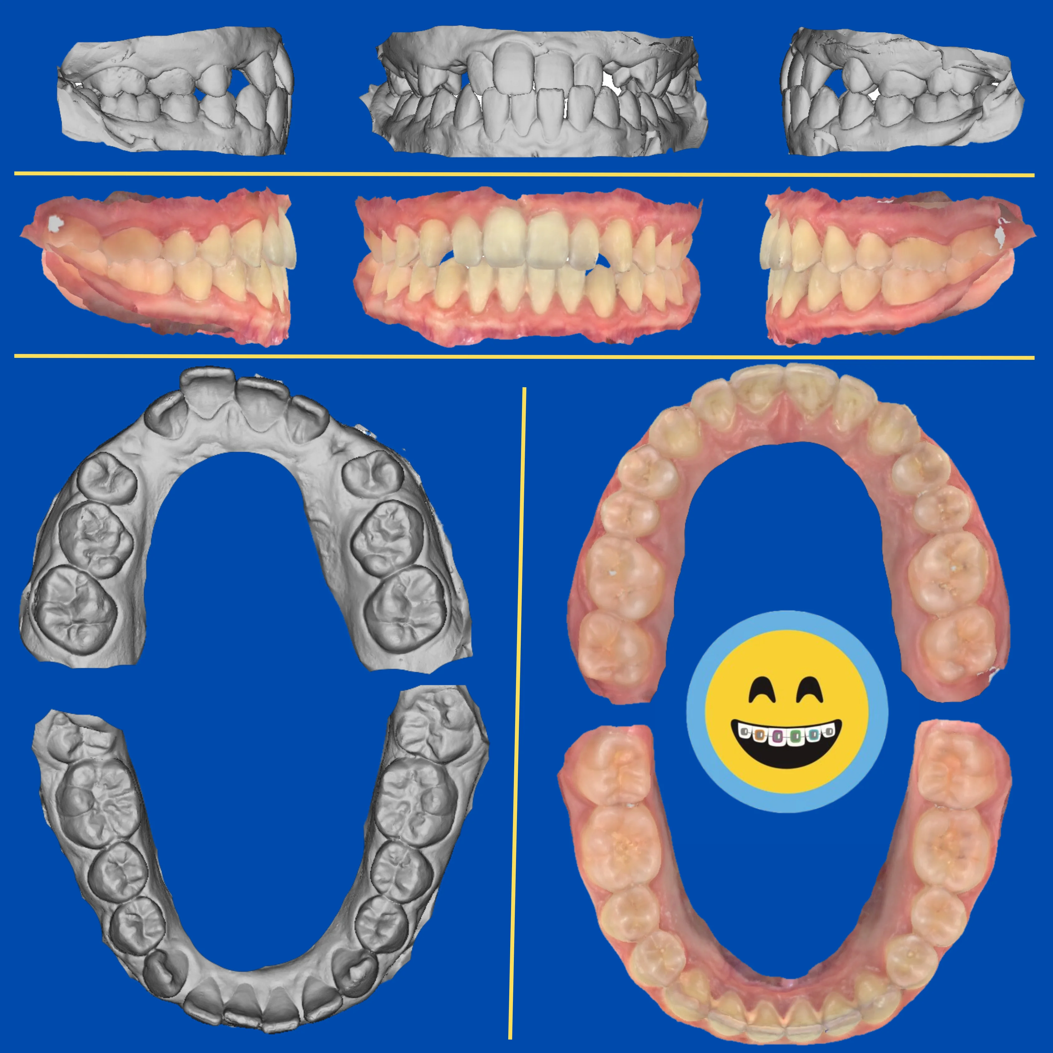 Mia - Before and After