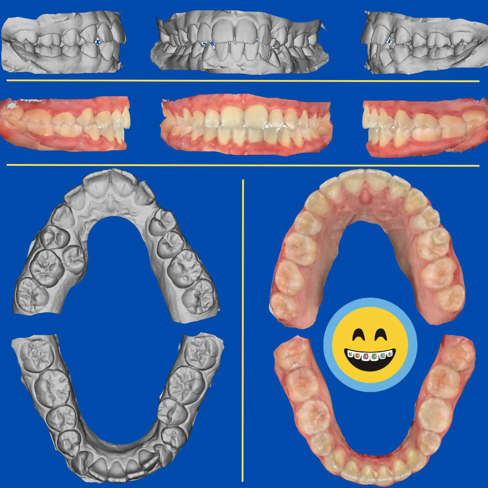 Dea - Before and After