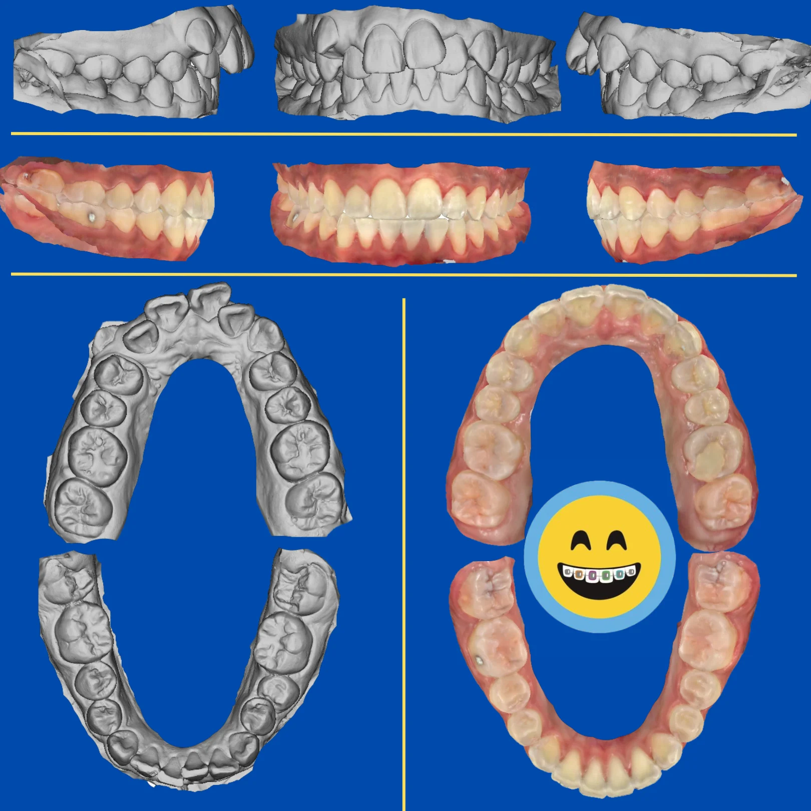 Shirley - Before and After