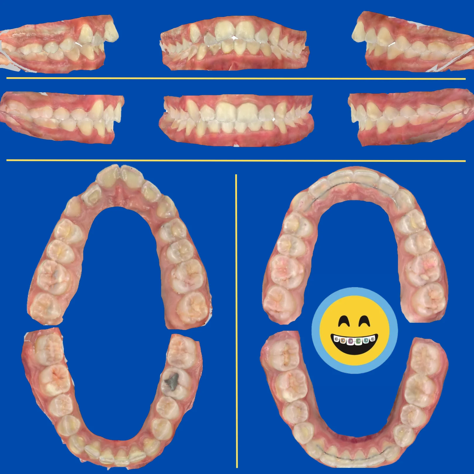 Dominic - Before and After