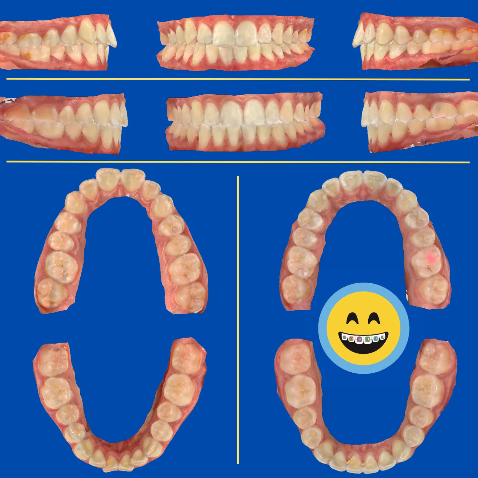 Cameron - Before and After