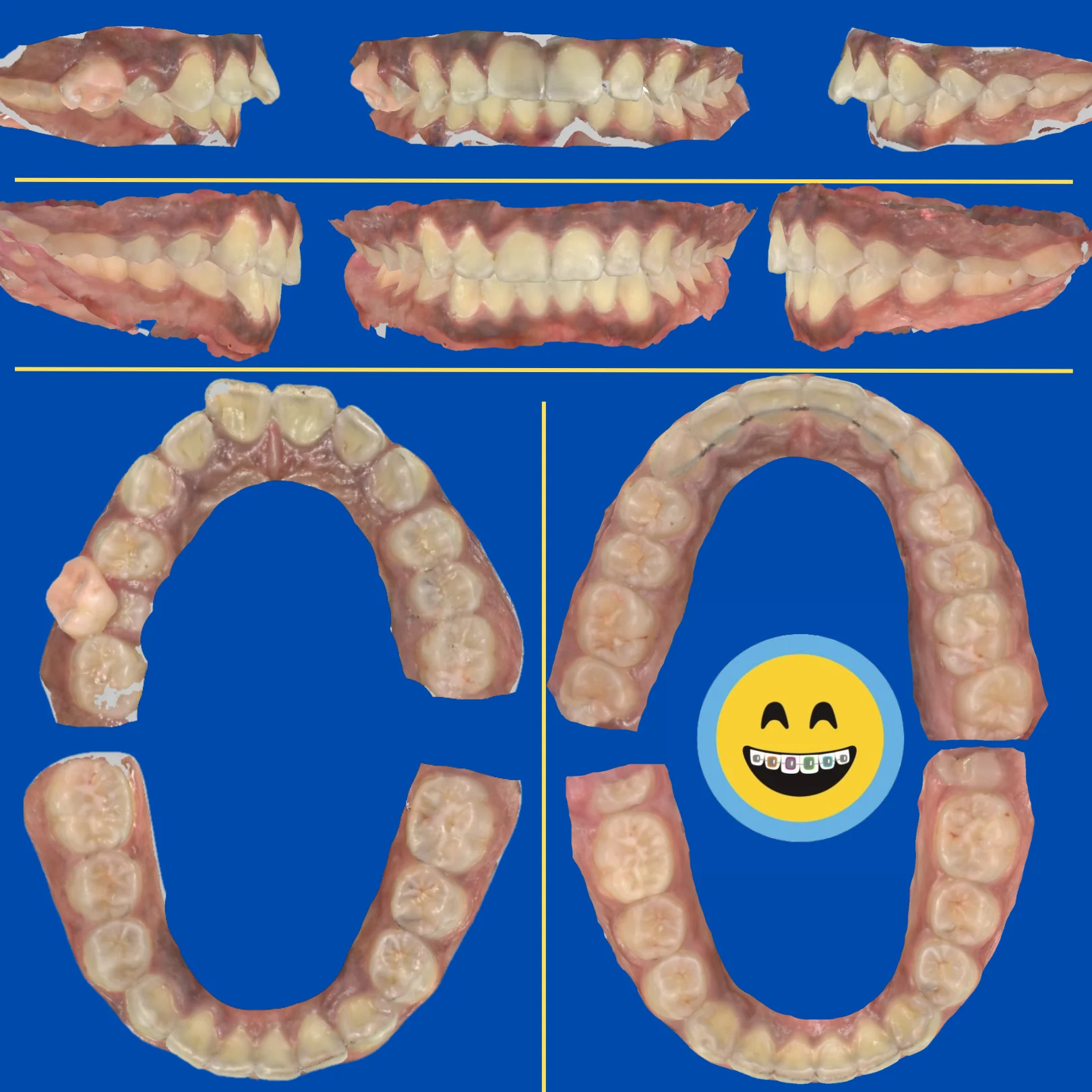 Davian - Before and After