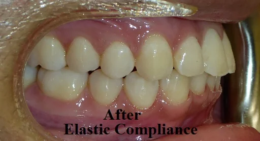 After - Results of good compliance