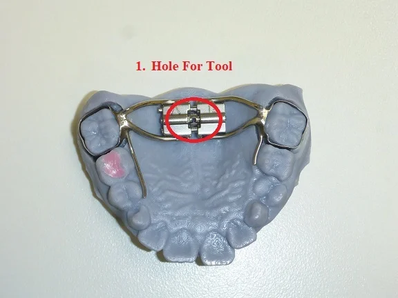 Expander Instructions Step 1