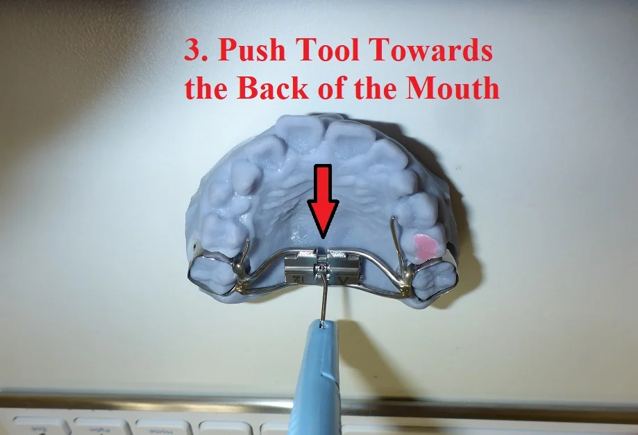Expander Instructions Step 4