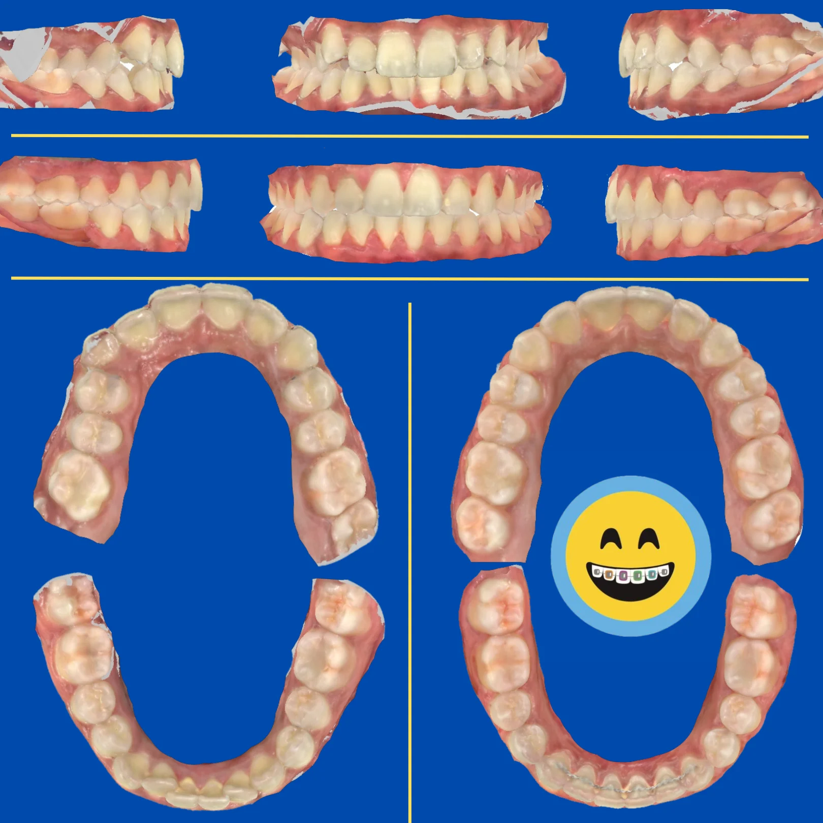Hajrah - Before and After