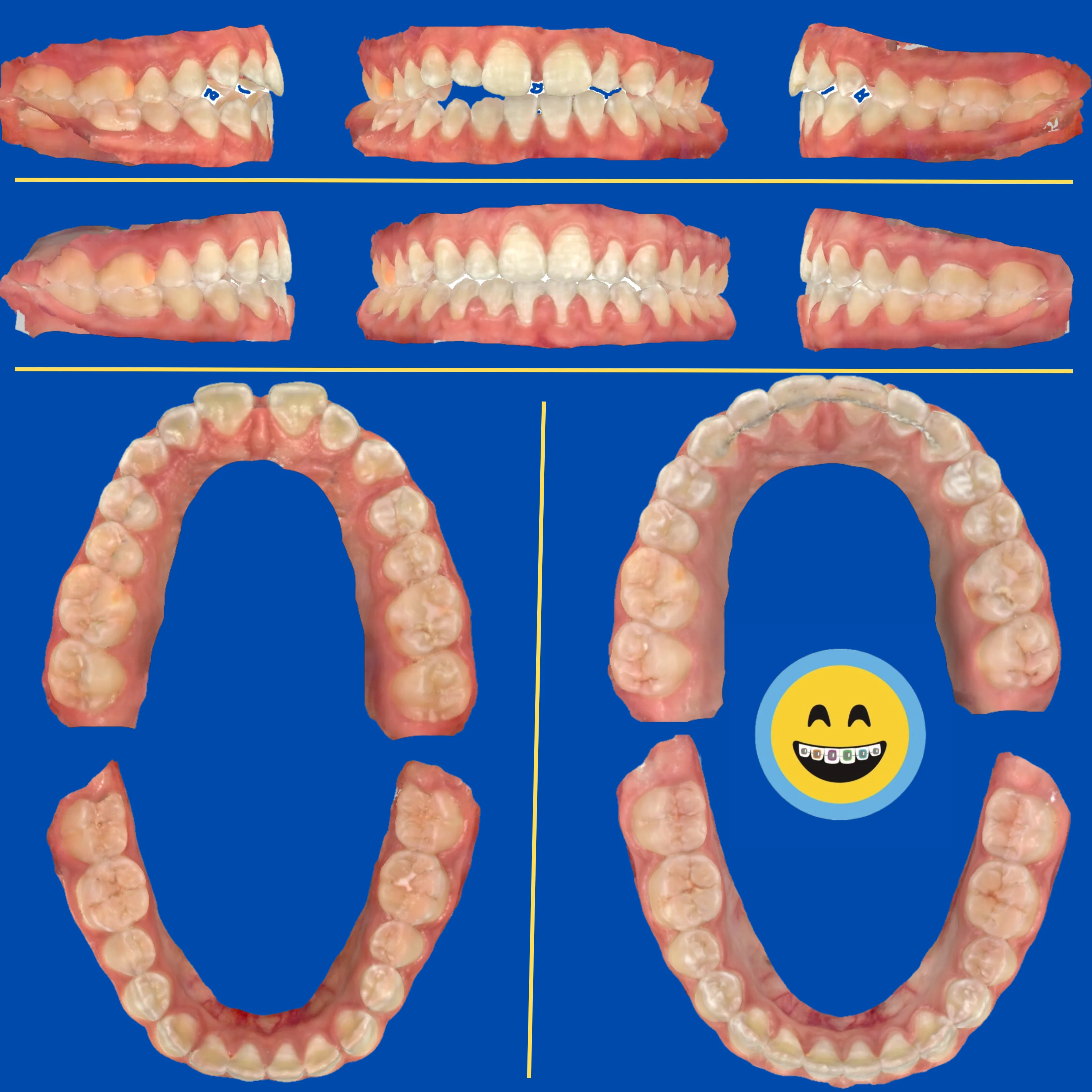 Trinity - Before and After