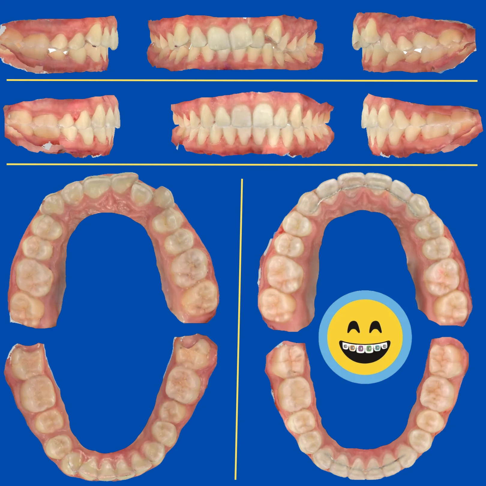 Kiera - Before and After